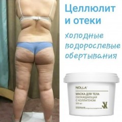 ЦЕЛЛЮЛИТ и ОТЁКИ Холодные водорослевые обёртывания