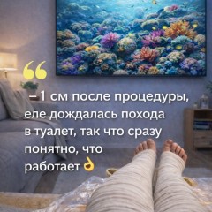 От отеков и целлюлита. Бандажное обертывание NOLLA®