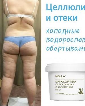ЦЕЛЛЮЛИТ и ОТЁКИ Холодные водорослевые обёртывания